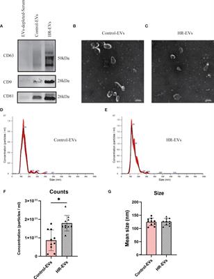 Serum CD203c+ Extracellular Vesicle Serves as a Novel Diagnostic and Prognostic Biomarker for Succinylated Gelatin Induced Perioperative Hypersensitive Reaction